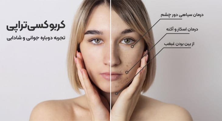 آموزش کربوکسی تراپی پوست - تخصصی و عملی - کلینیک تیارا طب